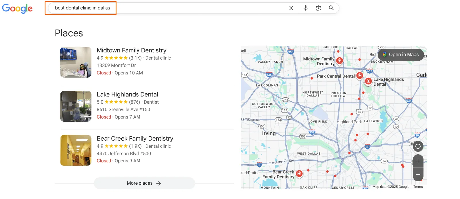 Most patients search for dentist near me or best dental clinic in dallas on Google